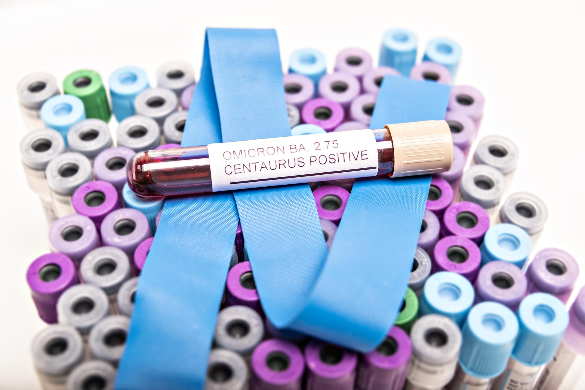 Selection of embroidered sample labels